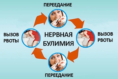 Лечение булимии в Новосергиевке